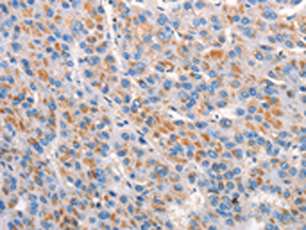 兔抗MRC1多克隆抗体