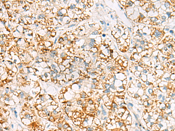 兔抗MRPL20多克隆抗体