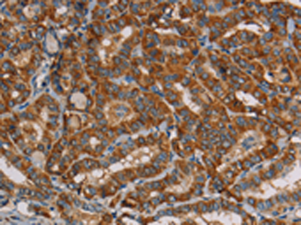 兔抗MRPL39多克隆抗体