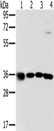 兔抗MRPL39多克隆抗体