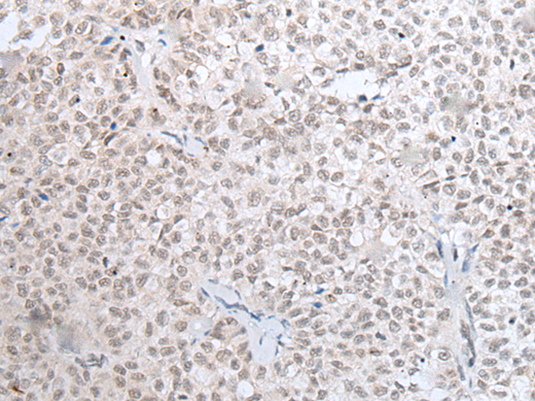  兔抗HOXC11多克隆抗体 