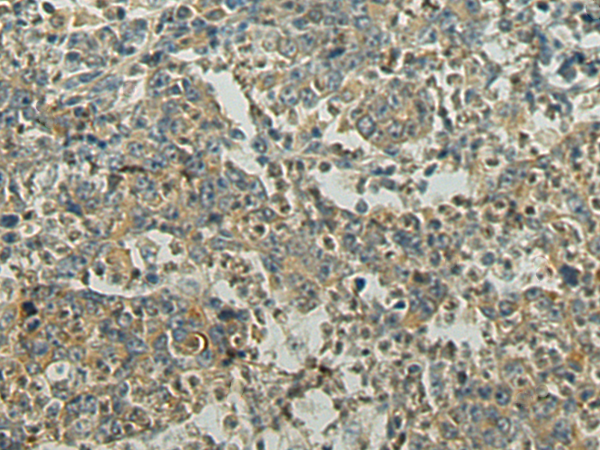 兔抗MRPL48多克隆抗体
