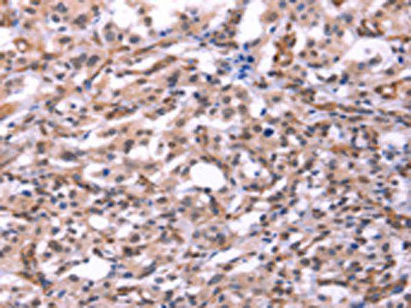 兔抗GCG(GLP2)多克隆抗体 