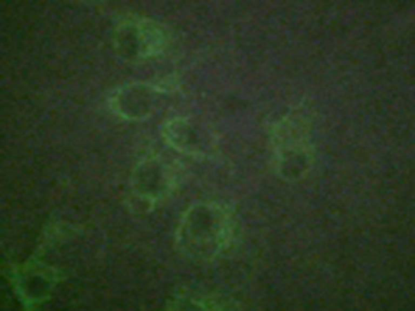 兔抗HRH1(Phospho-Ser398) 多克隆抗体 