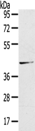兔抗HSD11B2多克隆抗体 