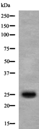 兔抗MT-ATP6多克隆抗体 