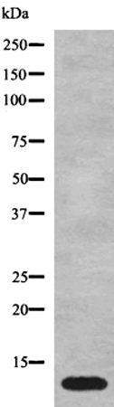 兔抗MT-ATP8多克隆抗体