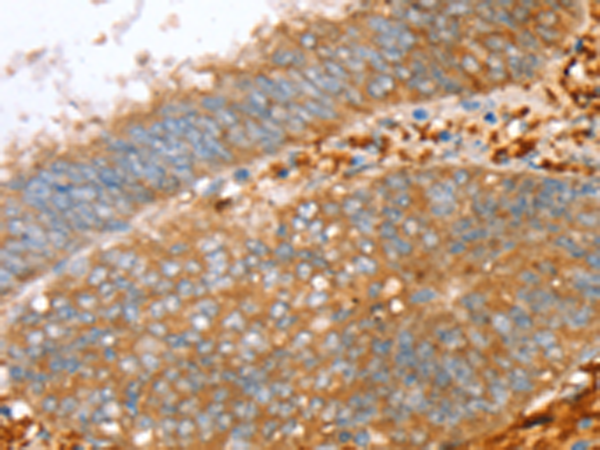 兔抗PTPN7多克隆抗体