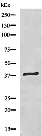 兔抗MT-ND2多克隆抗体 