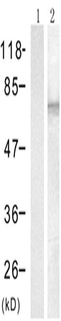 兔抗PTPN11 (Phospho-Tyr542)多克隆抗体