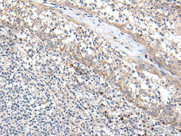 兔抗MT-ND5多克隆抗体