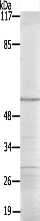  兔抗HSF1(Ab-121) 多克隆抗体 