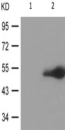 兔抗GFAP(Phospho-Ser38) 多克隆抗体 