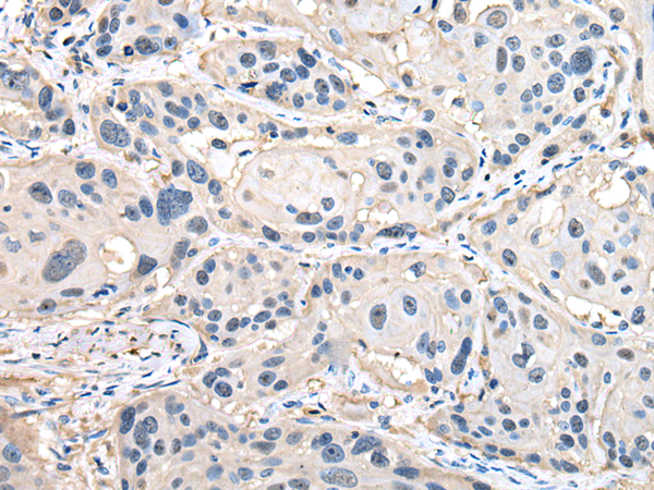 兔抗HSP90AB1多克隆抗体 
