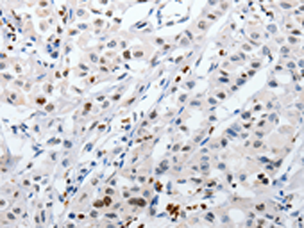  兔抗HSPA1A多克隆抗体 