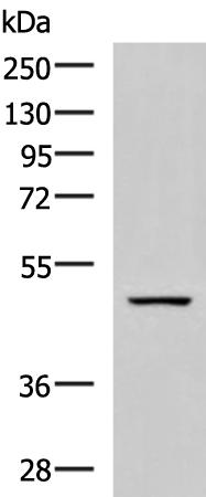 兔抗GFRA1多克隆抗体 