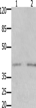 兔抗GFRA3多克隆抗体  