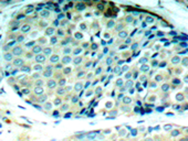 兔抗HSPB1 (Phospho-Ser78)多克隆抗体 
