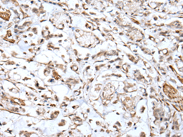 兔抗HSPB1多克隆抗体  