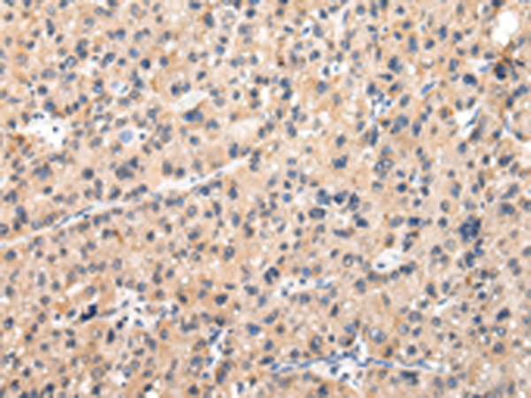 兔抗MUC1(NT)多克隆抗体 