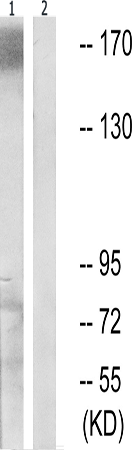 兔抗MUC1(Phospho-Tyr1229) 多克隆抗体