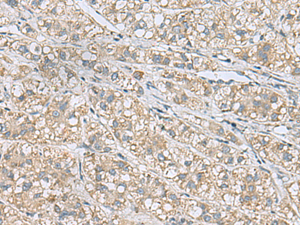  兔抗HSPB11多克隆抗体  