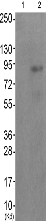 兔抗MUSK(Phospho-Tyr755) 多克隆抗体