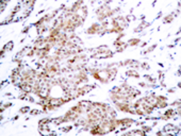 兔抗MYC (Phospho-Thr58) 多克隆抗体