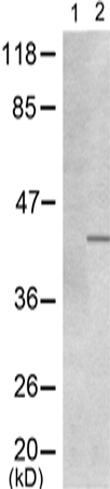 兔抗MYOD1(Phospho-Ser200)多克隆抗体