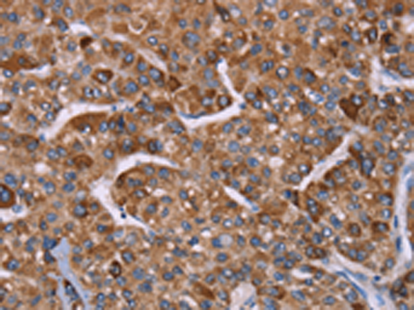 兔抗HSPE1多克隆抗体