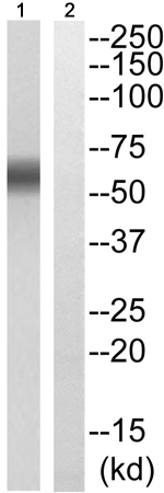 兔抗PXN(Phospho-Ser178) 多克隆抗体