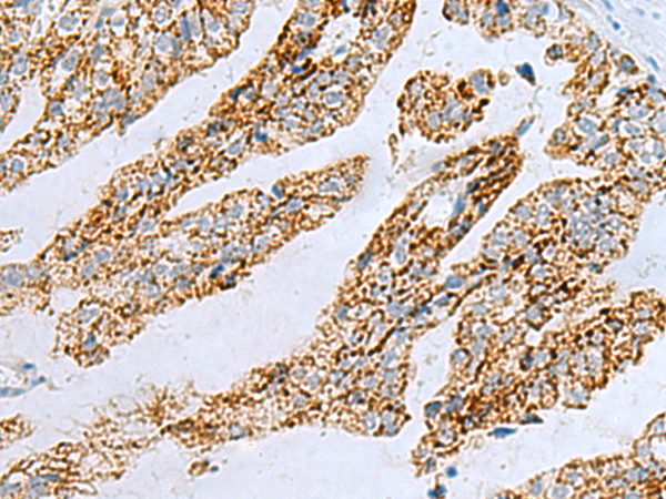 兔抗PYCR2多克隆抗体
