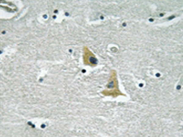 兔抗NCF1(Ab-345) 多克隆抗体 