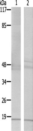 兔抗TSC22D1多克隆抗体