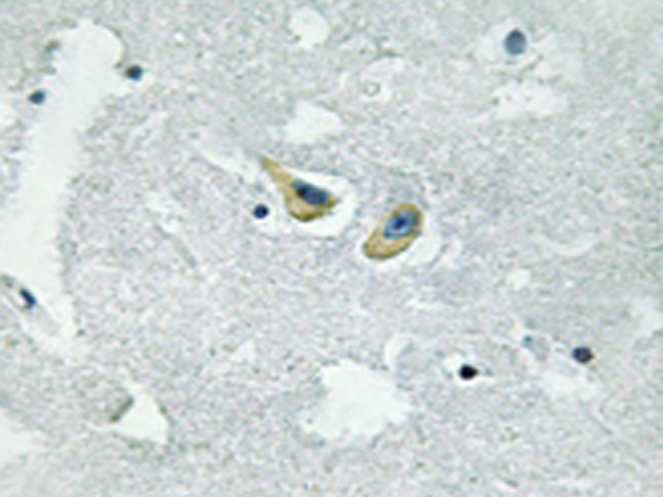兔抗NCF1(Phospho-Ser345) 多克隆抗体 