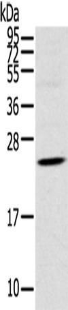 兔抗TSPAN13多克隆抗体   