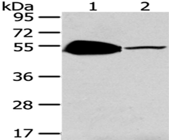 兔抗TSPYL1多克隆抗体 