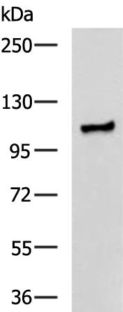 兔抗TTC16多克隆抗体  