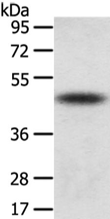 兔抗TTC23多克隆抗体  