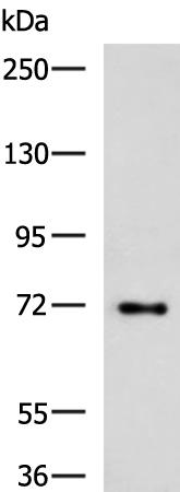 兔抗TTLL10多克隆抗体   