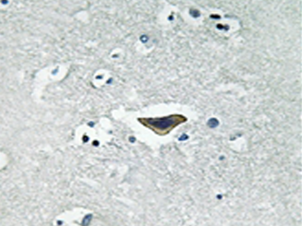 兔抗Rasgrf1(Phospho-Ser916) 多克隆抗体