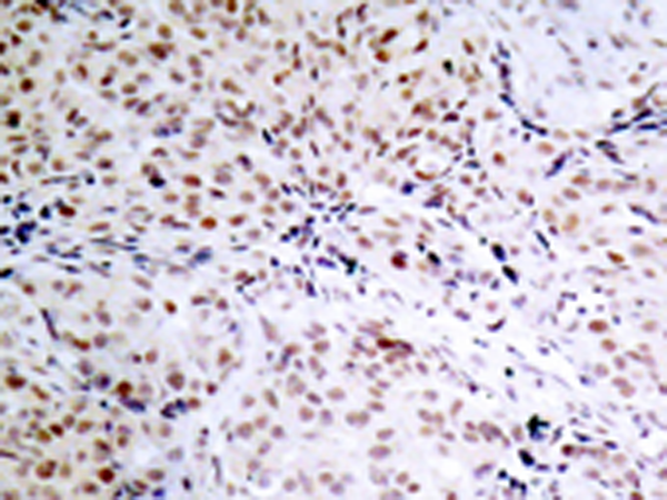兔抗RB1 (Phospho-Ser795)多克隆抗体