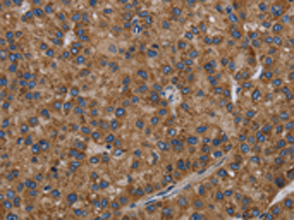 兔抗NECTIN2多克隆抗体