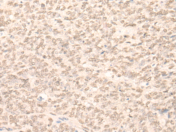 兔抗RBM17多克隆抗体