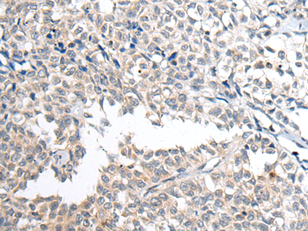 兔抗IFITM1多克隆抗体