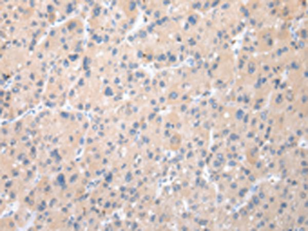兔抗TXNDC11多克隆抗体 