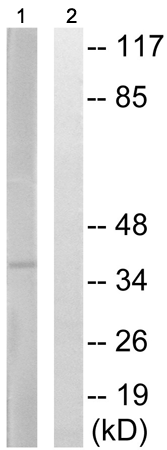 兔抗NEUROD1(Phospho-Ser274) 多克隆抗体