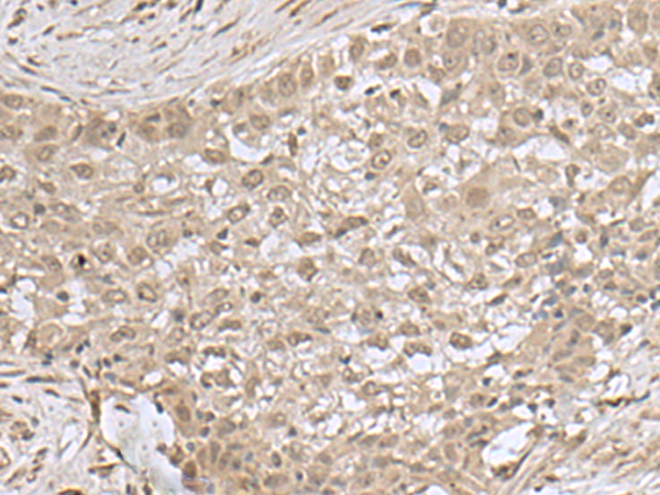 兔抗NEUROG3多克隆抗体