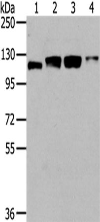 兔抗UBA1多克隆抗体