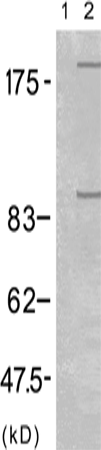 兔抗IGF1R (Phospho-Tyr1165/Tyr1166)多克隆抗体 